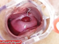 Close Up Masturbation Mature Medical 