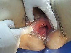 Close Up Medical Squirt Granny 