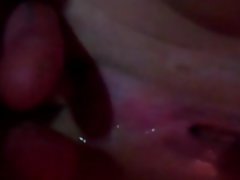 Amateur Anal Close Up Creampie Anal 